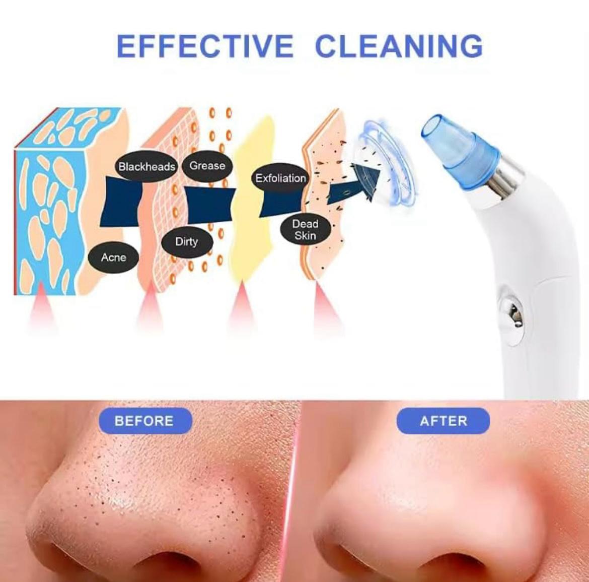 4 in 1 Multi-Function Blackhead Remover Tool